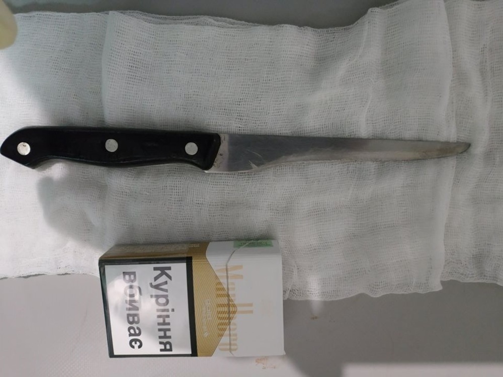 В Каменке-Днепровской мужчина 9 дней проходил с ножом в пищеводе
